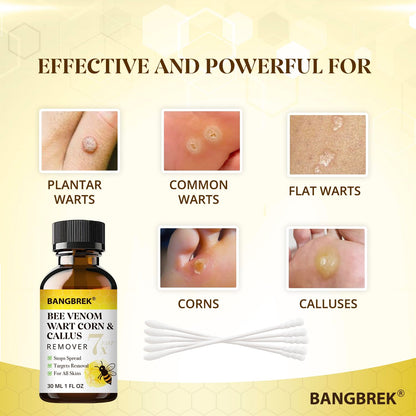Bangbrek Bee Venom Wart Remover — 17% Salicylic Acid Fast-Acting Wart & Callus Remover (1 fl oz)