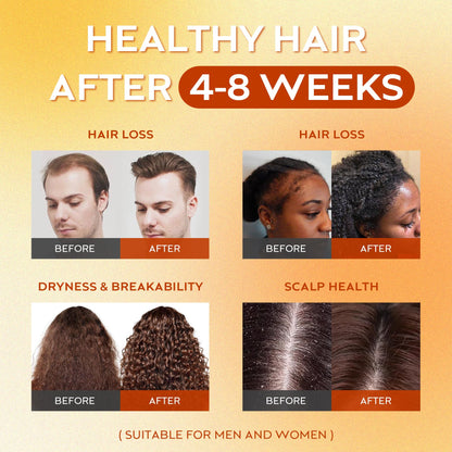 Batana Oil for Hair Growth – 2 fl oz | Raw Organic Batana Oil, Honduras