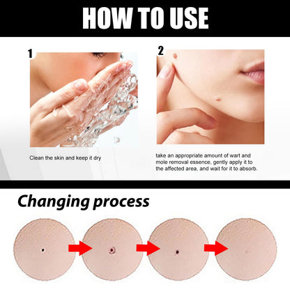 Befada Skin Mole Remover for Face & Body – Precision Dropper Serum, Fast-Acting Wart & Mole Care (10ML)