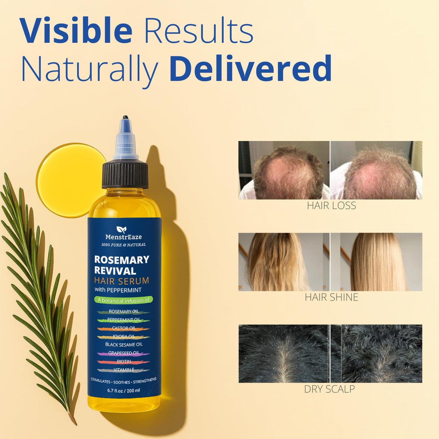 8-Oil Hair Growth Oil & Scalp Treatment - Rosemary, Peppermint, Biotin | 6.7 fl oz
