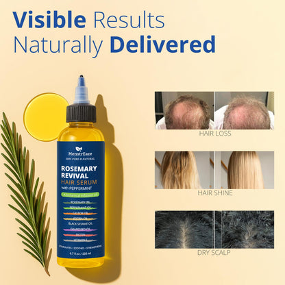 8-Oil Hair Growth Oil & Scalp Treatment - Rosemary, Peppermint, Biotin | 6.7 fl oz