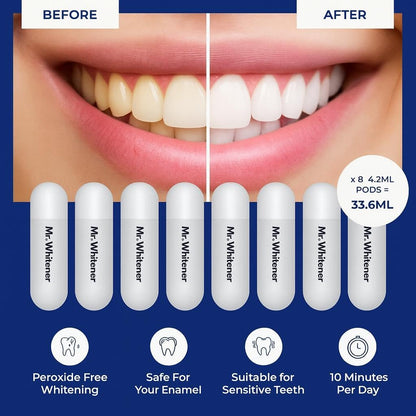 Mr. Whitener LED Teeth Whitening Kit – Dentists Recommended, Enamel Safe, Sensitive Teeth, 8 Refill Pods (33.6ml)