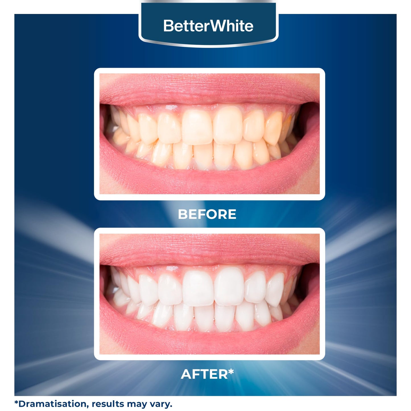 BetterWhite Teeth Whitening Powder – Hydroxyapatite, Remineralizing, Fluoride-Free (30g)
