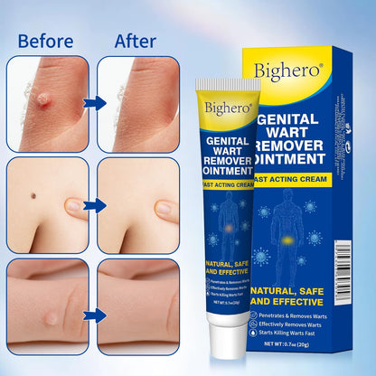 Bighero 2-Pack Wart Fast Acting Gel – Genital Warts, Plantar Warts, Common Warts & Corn