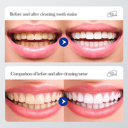 BIOAQUA 1.5X Instant Whitening Toothpaste – Fresh Breath, Gingival Protection 100g