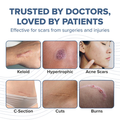 BIODERMIS ProSIL Silicone Scar Stick – Non-Invasive Scar Gel for Surgical, Acne & Burn Scars (17g)