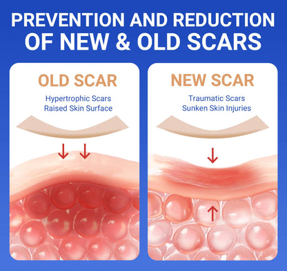 Bioemmalab Silicone Scar Sheets - Medical Grade Tape Roll (1.6" x 150") for Post-Surgical, Acne & Keloid Scars