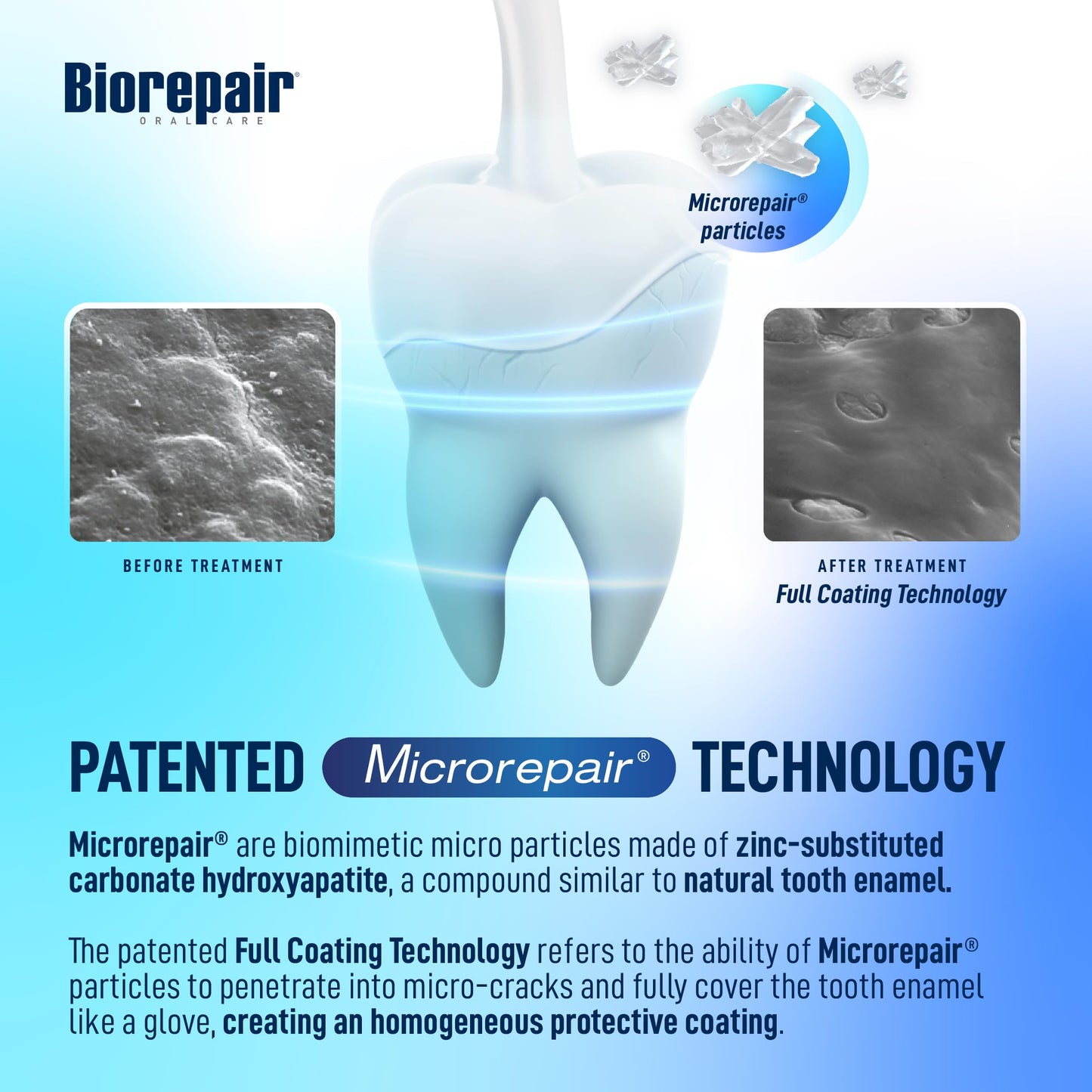Biorepair Total Protection Plus Toothpaste w/microRepair Hydroxyapatite – No Fluoride – Remineralize & Repair Enamel – 2.54oz