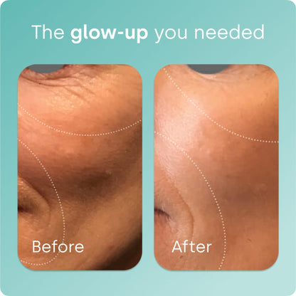 Biosil Collagen Booster - 60 Capsules | Patented ch-OSA Activator