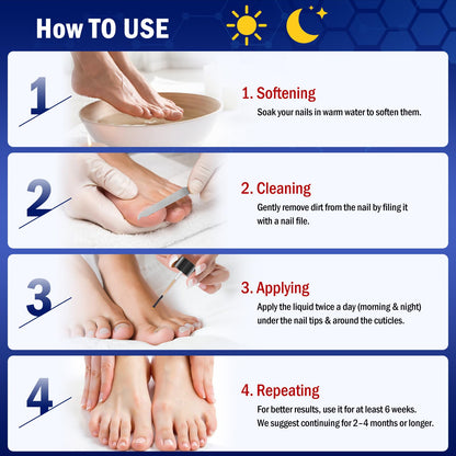 Bldaxn Toe Nail Fungus Renewal – Fast Acting 1 Pack for Thick, Discolored Nails