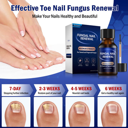 Bldaxn Toe Nail Fungus Renewal – Fast Acting 1 Pack for Thick, Discolored Nails