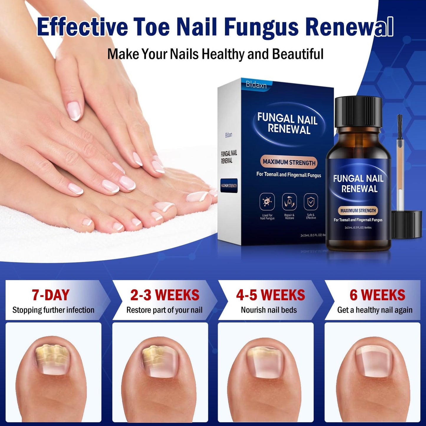 Bldaxn Toe Nail Fungus Renewal – Fast Acting 1 Pack for Thick, Discolored Nails