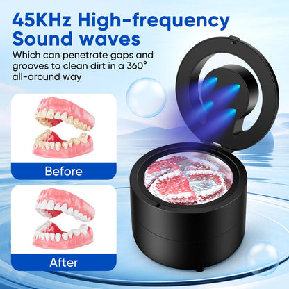 BlumWay Retainer Cleaning Machine – 45kHz for Dentures, Braces & Mouth Guards