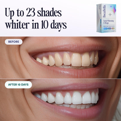 Boca Bella Teeth Whitening U-Wraps – 10 Treatments, 15% Hydrogen Peroxide, Enamel-Safe