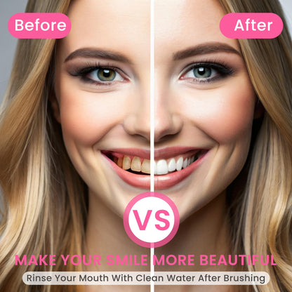 BodyAccel Niacinamide Whitening Toothpaste – Stain Removal, Gentle Care, Fluoride-Free