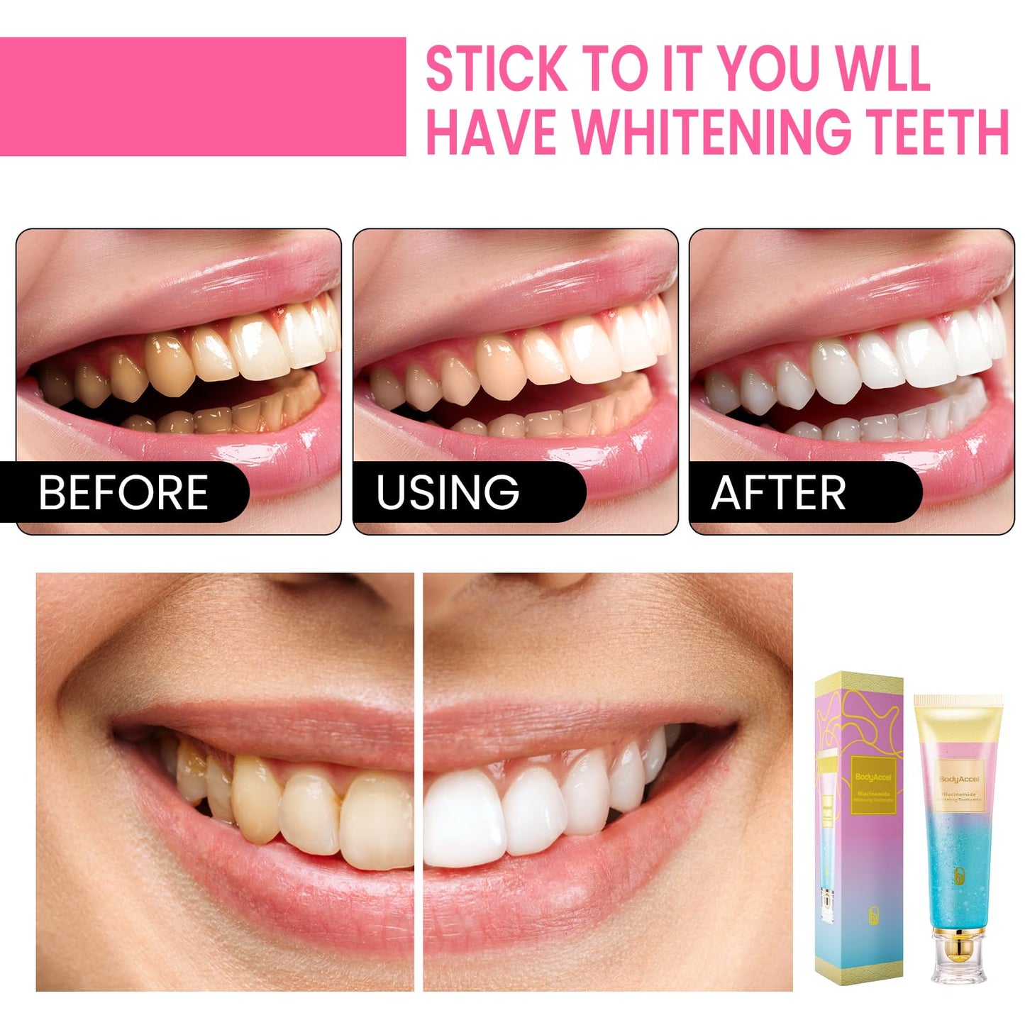 BodyAccel Niacinamide Whitening Toothpaste – Stain Removal, Gentle Care, Fluoride-Free