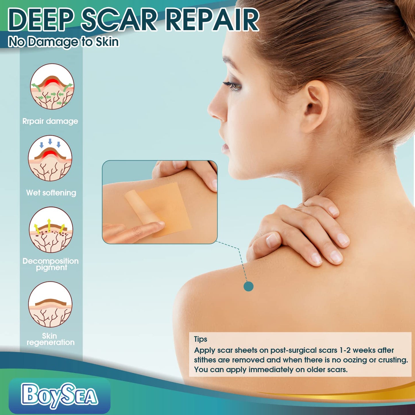 Boysea Professional Silicone Scar Sheets Roll 1.6x150 in | Reusable Scar Tape for Keloid, C-Section, Surgery, Burn & Acne