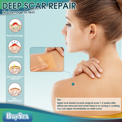 Boysea Professional Silicone Scar Sheets Roll 1.6x150 in | Reusable Scar Tape for Keloid, C-Section, Surgery, Burn & Acne