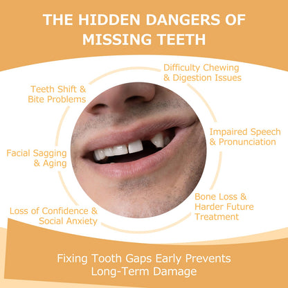Partial Dentures (2 Teeth) – Lightweight, Durable Replacement Teeth for Missing Teeth