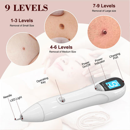 Breaspec LM 1000 SkinTag Remover - At-Home Wart & Skin Tag Kit