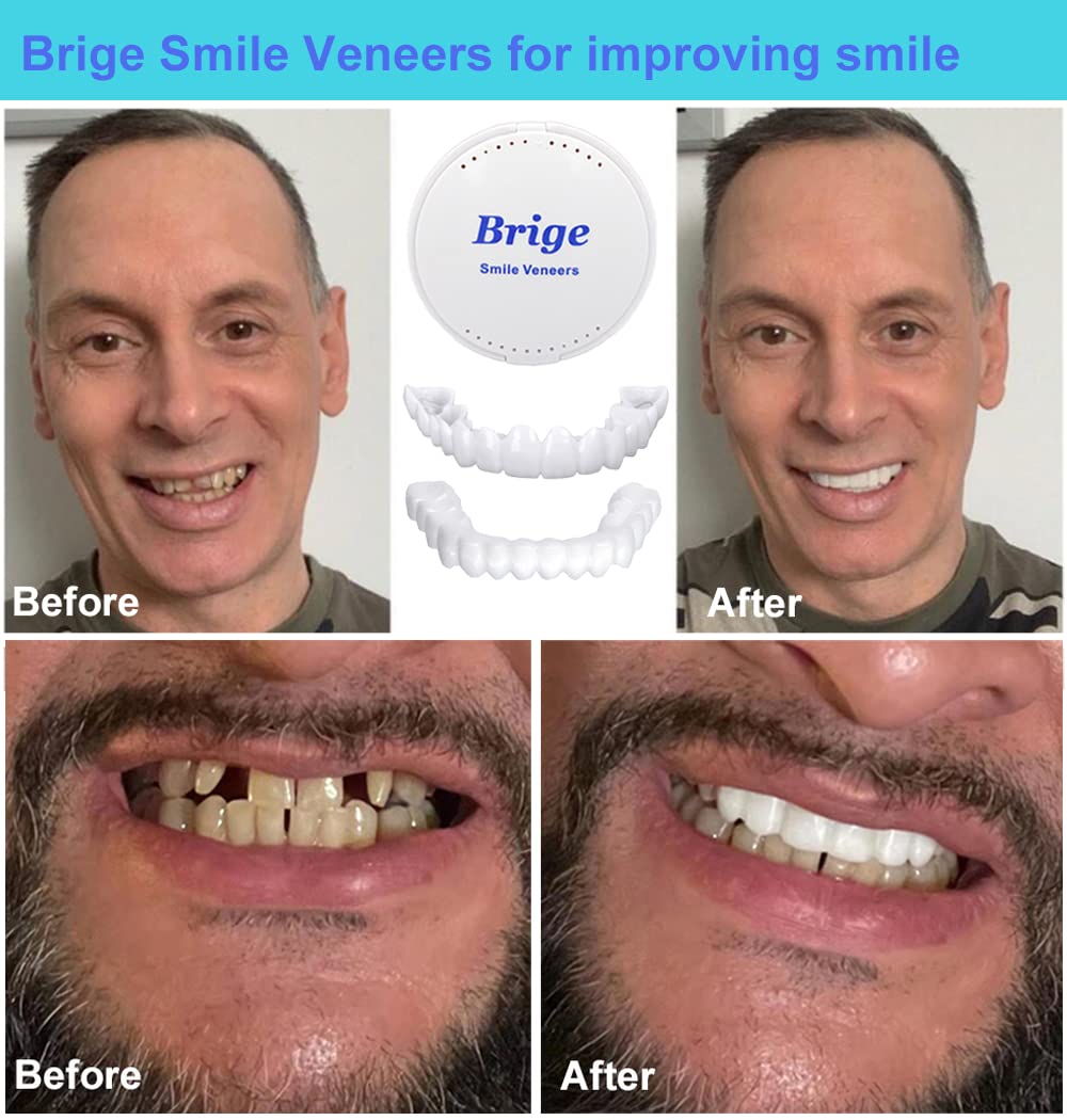 Brige Smile Teeth Denture - Temporary False Teeth to Improve Your Smile