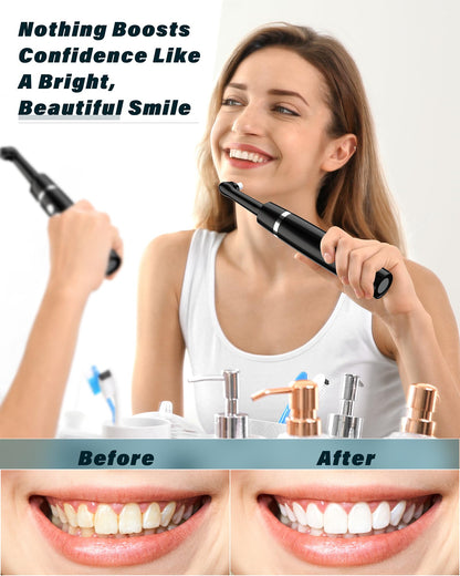 Tooth Polisher Rechargeable Whitening Kit - 3 Pastes, 5 Heads, LED Light (Black)