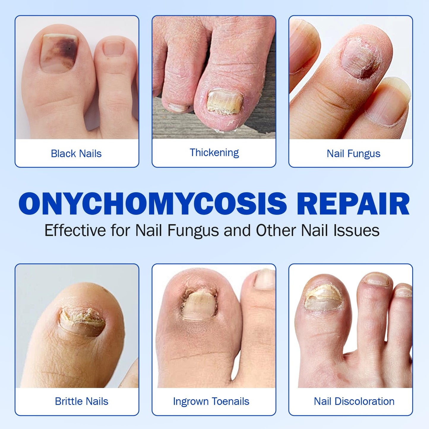 Cacukn Toenail Treatment Extra Strength Patches – Overnight Renewal (21 Pcs)