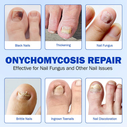Cacukn Toenail Treatment Extra Strength Patches – Overnight Renewal (21 Pcs)