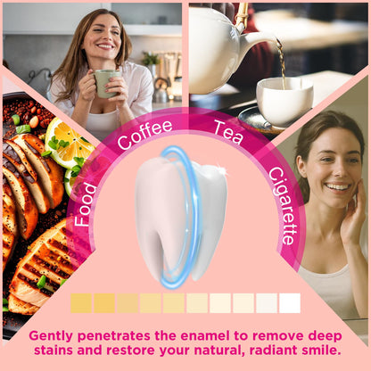 CALLSMILE Teeth Whitening Strips - Sensitive Teeth, Coconut Formula, 28 Strips (14 Days)