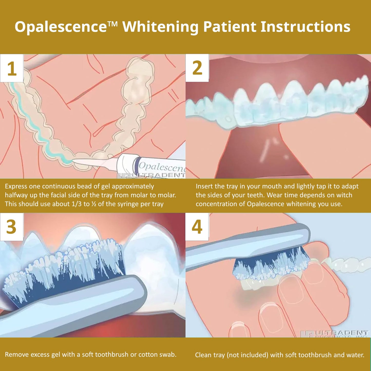 Opalescence 45% Teeth Whitening Gel – 8-Syringe Refill Kit (Mint, PF) by Ultradent