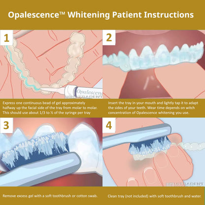 Opalescence 45% Teeth Whitening Gel – 8-Syringe Refill Kit (Mint, PF) by Ultradent