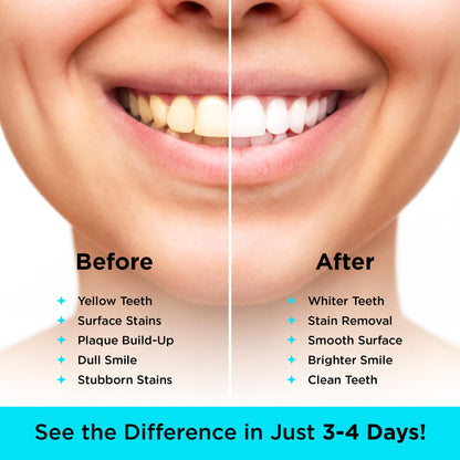 CARBON WHITE Teeth Whitening Powder - Natural Coconut Charcoal 30g