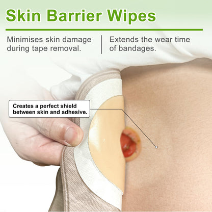 CARBOU Skin Barrier Wipes – 100 Count Skin Prep for Enhanced Adhesion