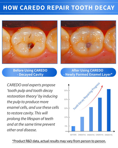 CAREDO Cavity Repair Toothpaste Set – 100g Hydroxyapatite + 16g Pulpitis Ointment