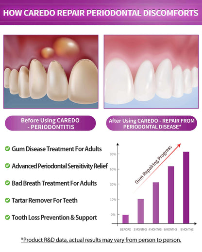 CAREDO Gum Toothpaste for Periodontitis & Gum Disease | Receding Gums, Gingivitis & Bad Breath - 3.52 oz