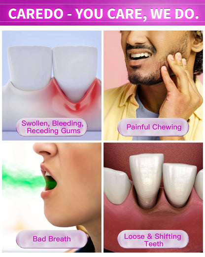 CAREDO Gum Toothpaste for Periodontitis & Gum Disease | Receding Gums, Gingivitis & Bad Breath - 3.52 oz