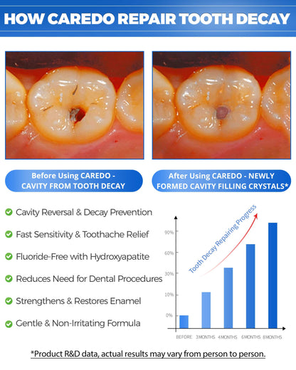 CAREDO Cavity Reversal Toothpaste – Hydroxyapatite, Fluoride Free, 2-Pack