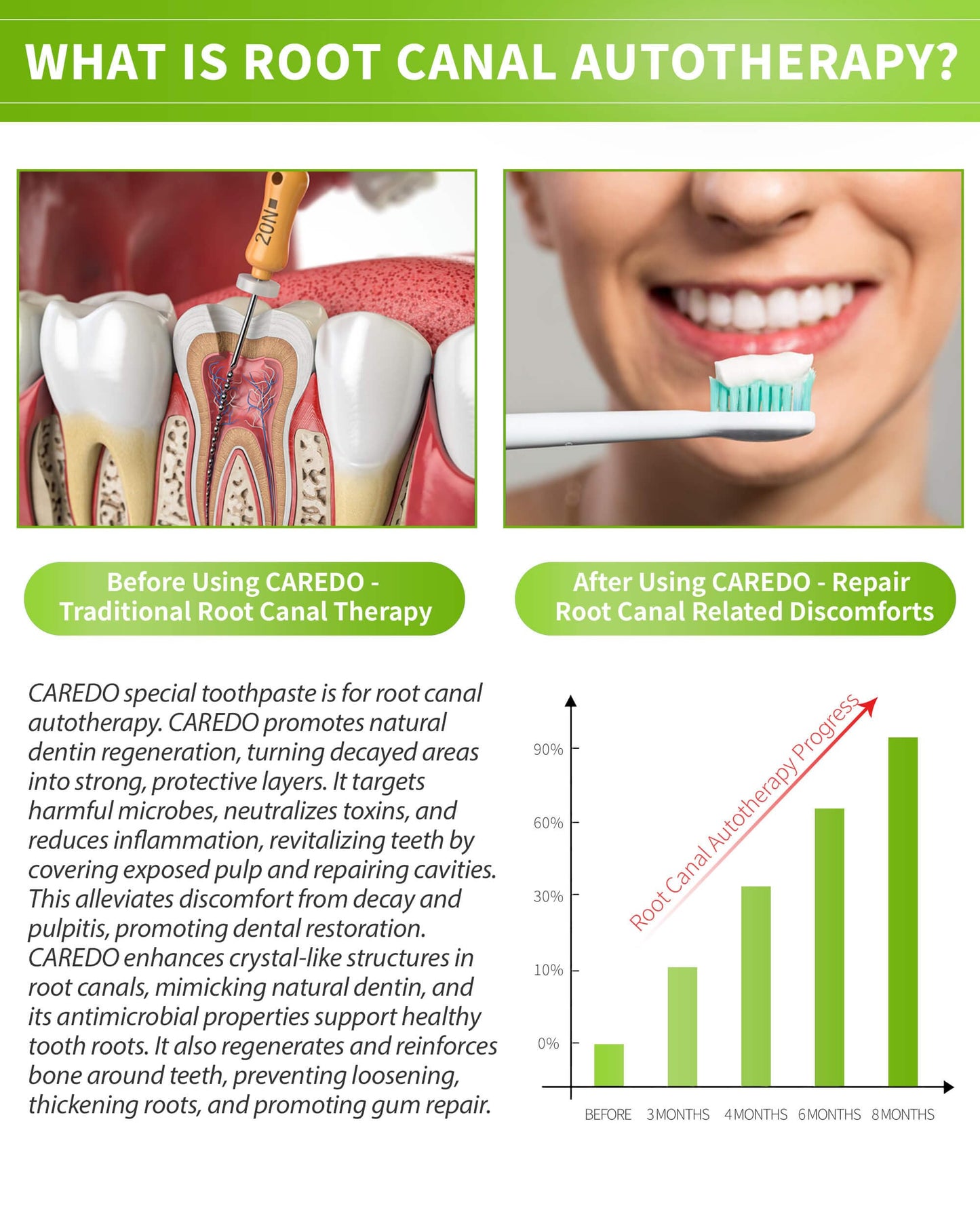 CAREDO Toothpaste Gum Repair for Root Canal Autotherapy - Mint 3.5 Oz x 2 Tubes