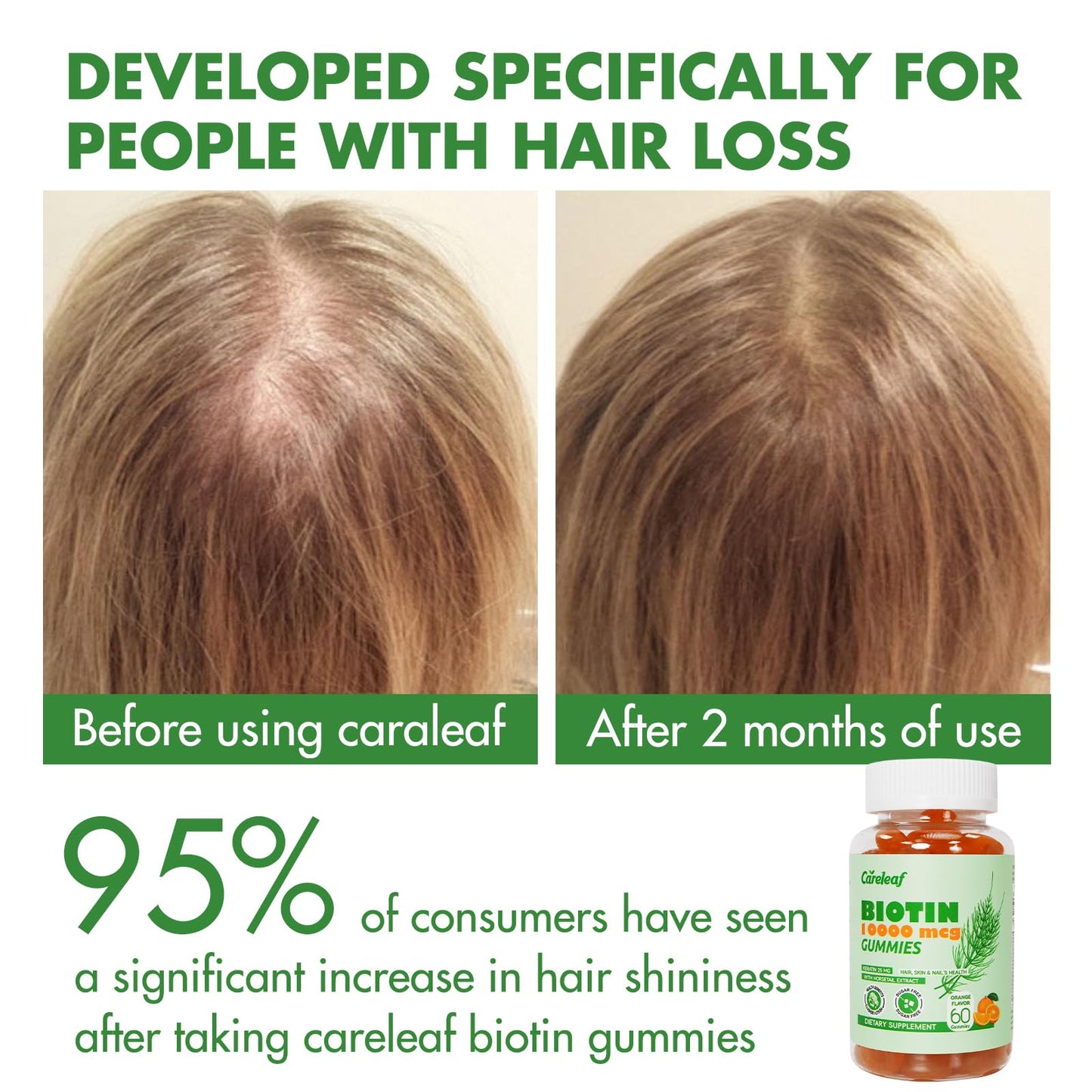 Careleaf Biotin Gummies – 10000 mcg Biotin for Hair Growth, Nails & Skin | 60 Count, Orange