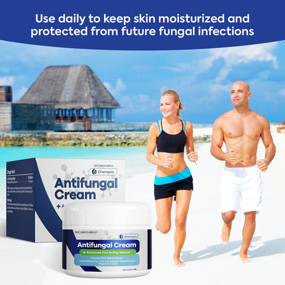 CHARMPOO Antifungal Cream for Itchy Skin Relief — Extra Strength Ringworm & Athlete's Foot Treatment (3.4 oz)