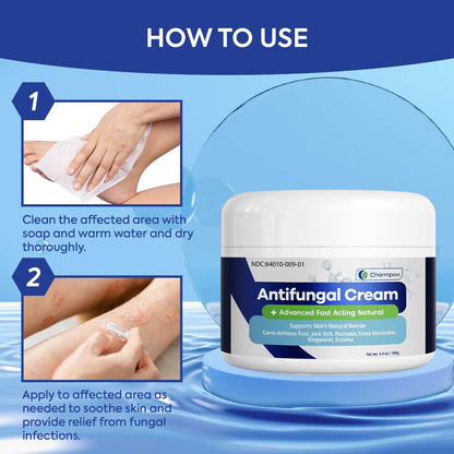 CHARMPOO Antifungal Cream for Itchy Skin Relief — Extra Strength Ringworm & Athlete's Foot Treatment (3.4 oz)