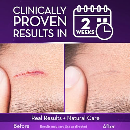 Cicatricure Advanced Scar Gel for Face & Body – Visible Results in 2 Weeks