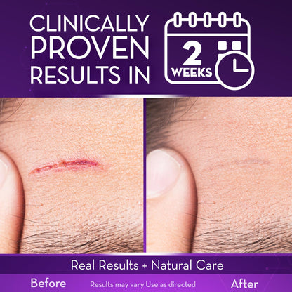 Cicatricure Advanced Scar Gel for Face & Body – Visible Results in 2 Weeks