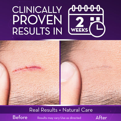 Cicatricure Advanced Scar Gel for Face & Body - Visible Results in 2 Weeks | Scar Treatment for Surgical, Acne, Burns, Stretch Marks | Pack of 2