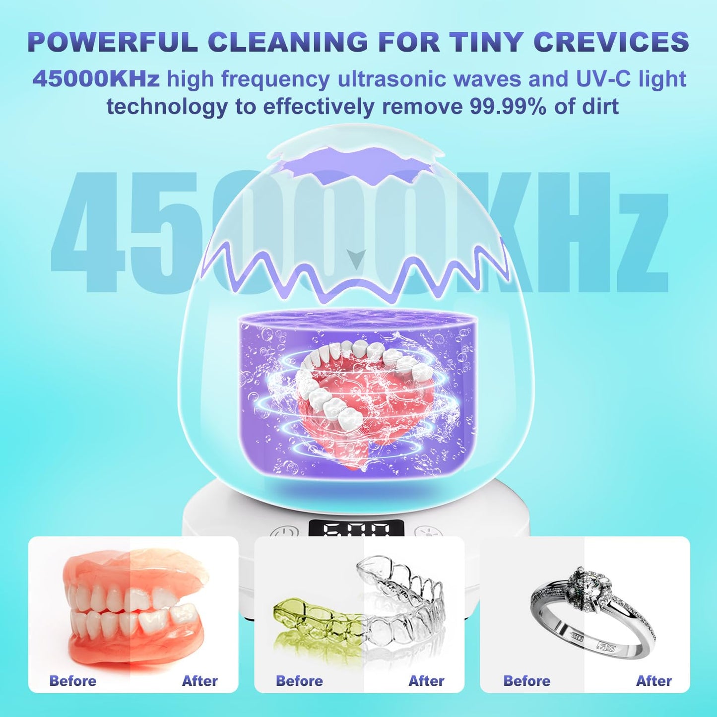 Ultrasonic Retainer Cleaner 45kHz – Denture & Aligner Cleaning Machine