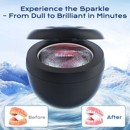 Ultrasonic Retainer Cleaner 2025 Upgraded – 45kHz 200ml for Dentures, Braces & Jewelry