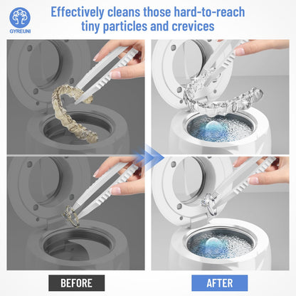 Ultrasonic Retainer Cleaner with Tablets and Brush Kit - UV Sonic Cleaner