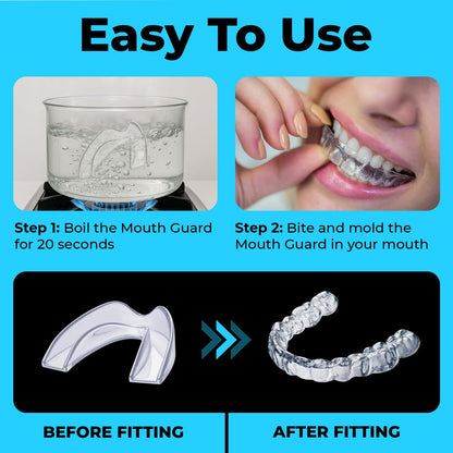 Mouth Guard for Teeth Grinding at Night | MONIER Night Guard