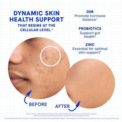 Clear Skin Supplement with Zinc, DIM & Probiotics | 60 Count