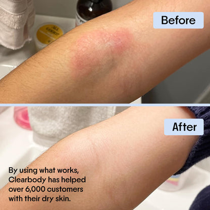 Clearbody Organics Manuka Honey Cream – Soothing Eczema Relief & Deep Hydration (2 oz)